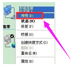 解决办法：当本地连接2显示为受限制或无连接状态时的处理方法